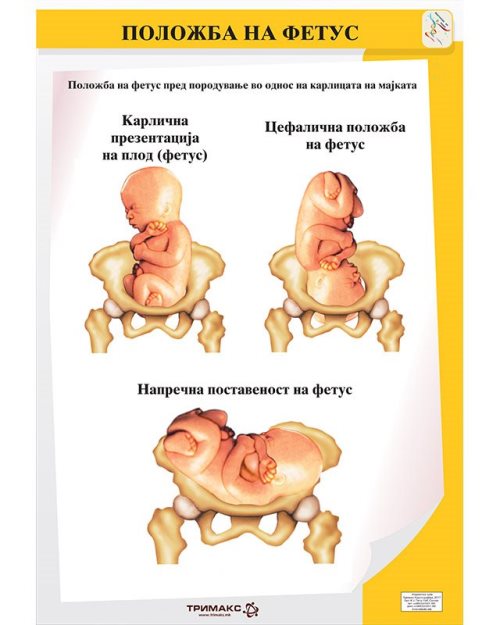 БП104 - Положба на фетусот (постер)